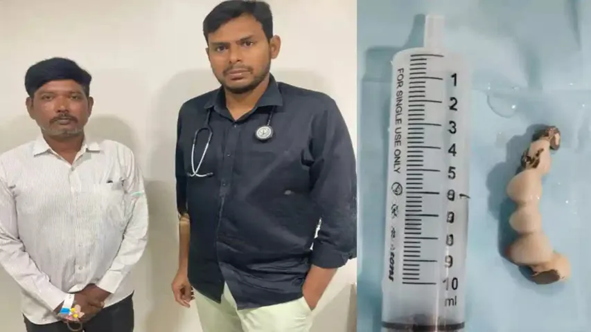 man swallow teeth set in Visakhapatnam