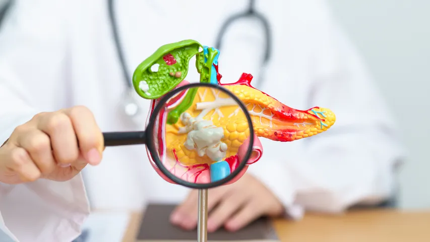 Bad Cholesterol