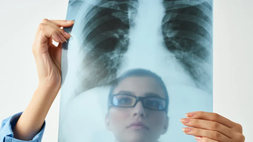 Lungs