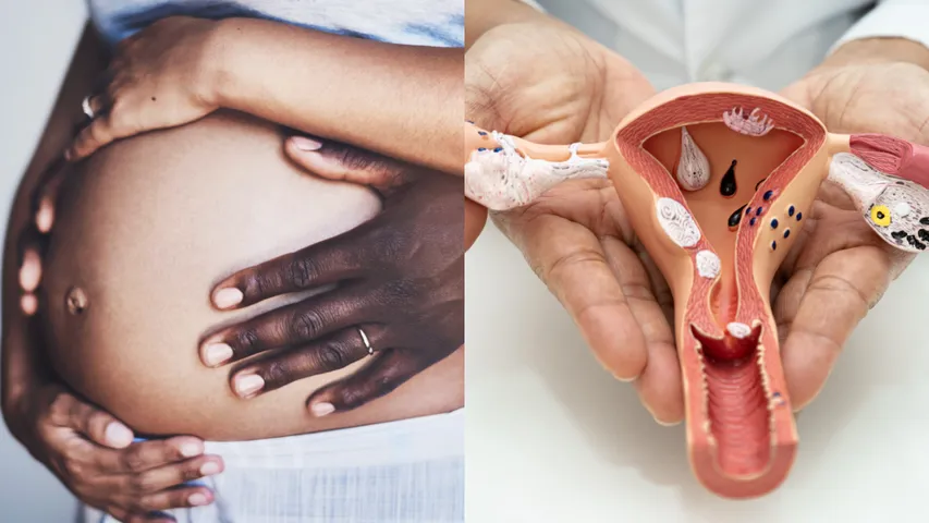 vaginal steaming