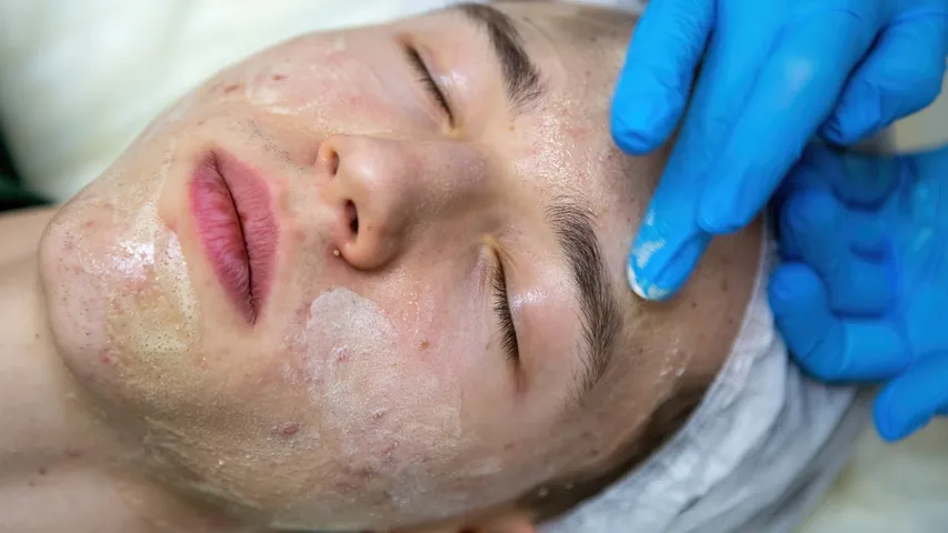 Unwanted hair
