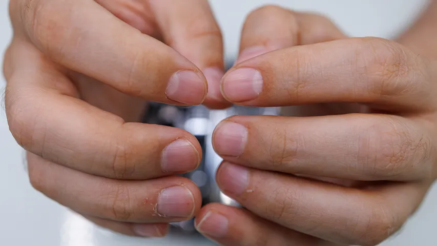 Nail 