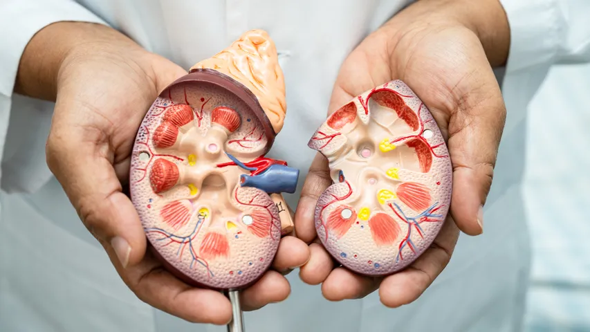 polycystic kidney disease