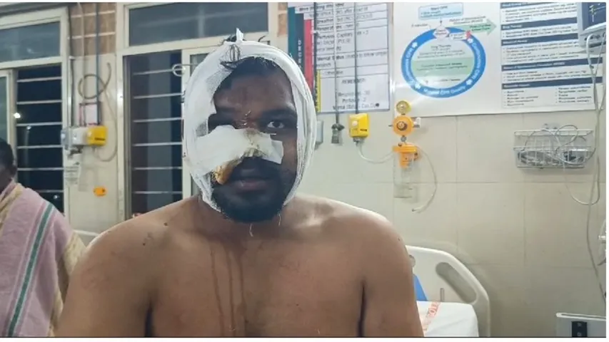 Road Robbery in Nandyal