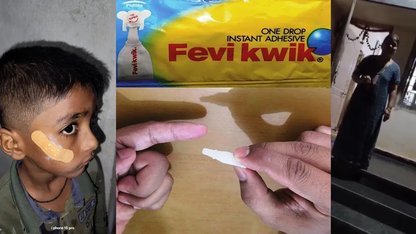 Feviquick
