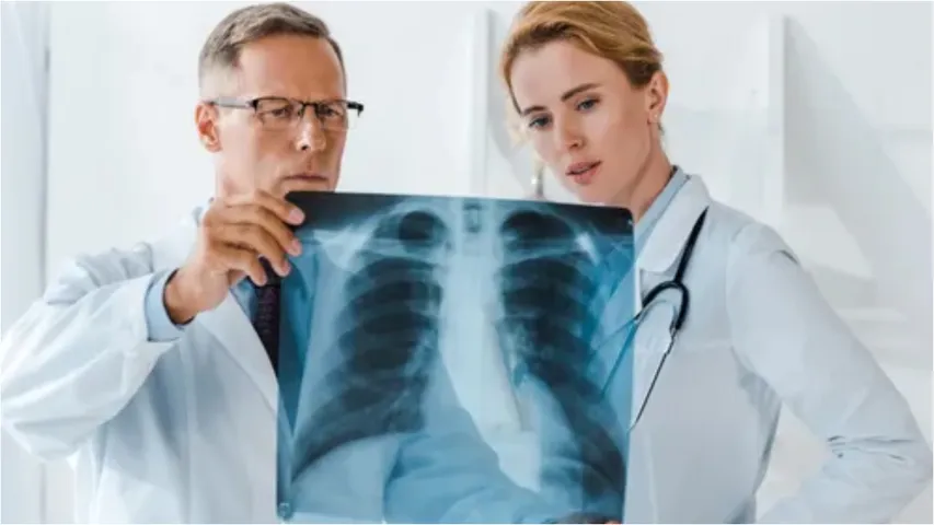 lung cancer