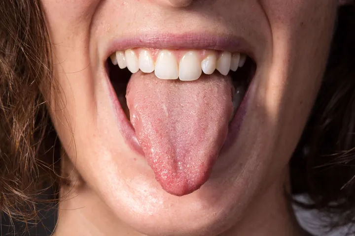 tongue