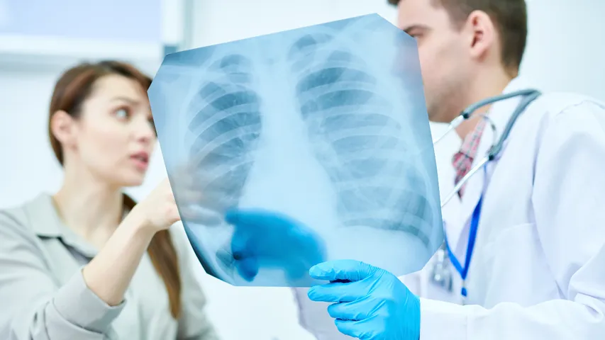 Lung Symptoms