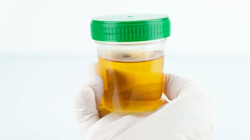 Urine