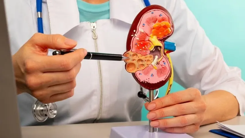 Kidney Racket