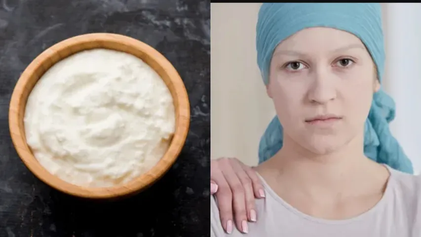 curd helps in colon cancer