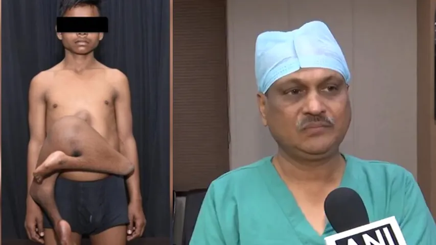 delhi aims
