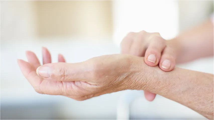 Arthritis