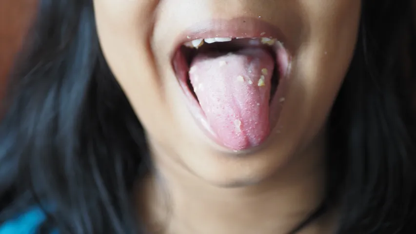 Tongue 