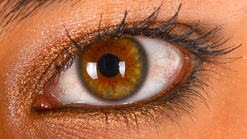 Eye 