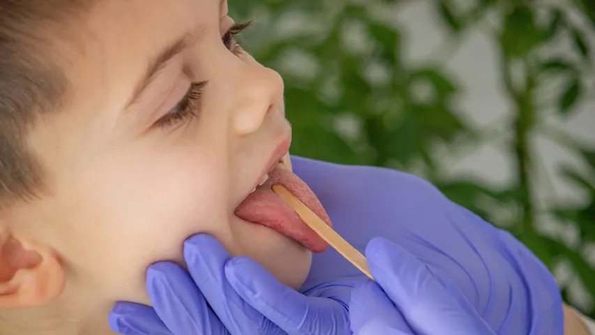 Tongue Clean