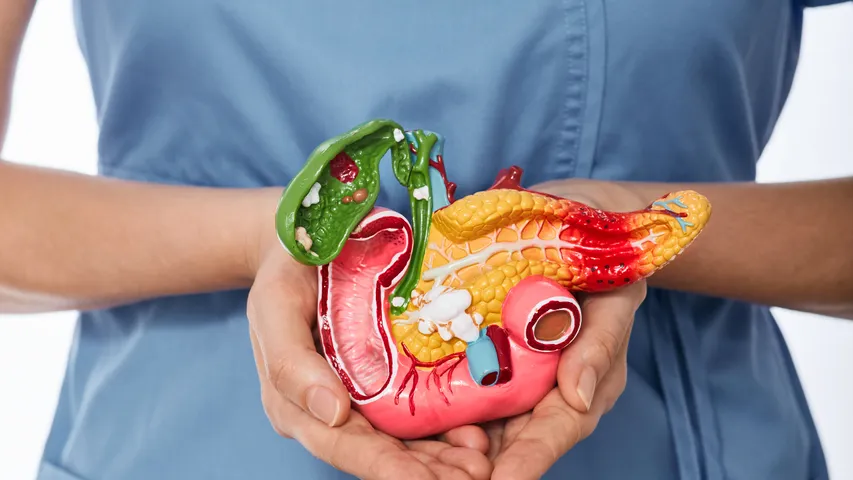 Cholesterol 