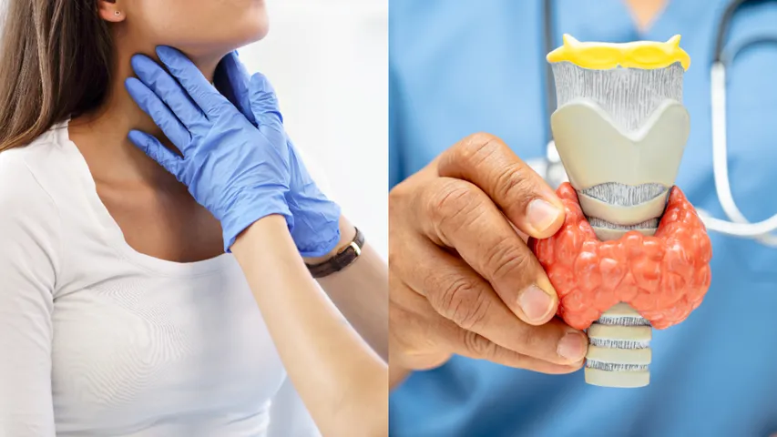 Thyroid
