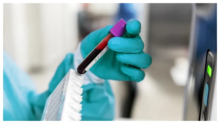 TG Free Cancer Test