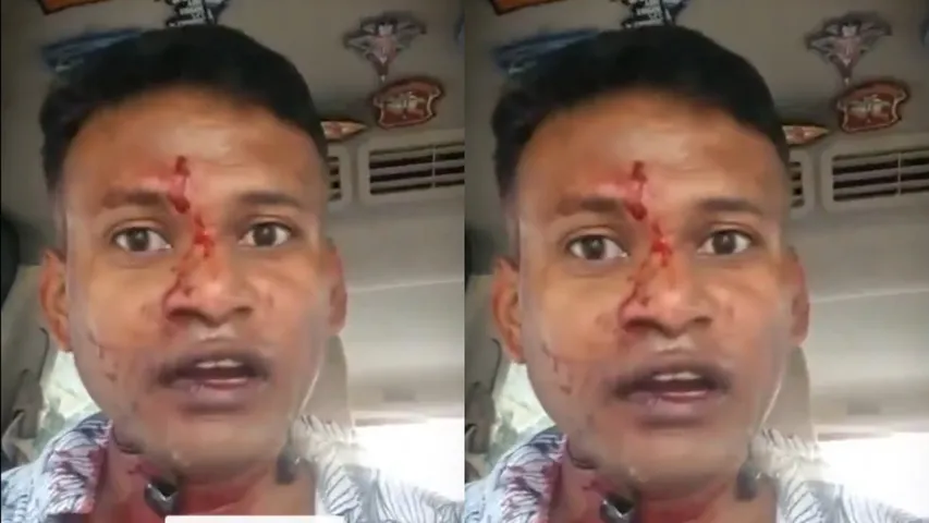 IAF officer, wife brutally attacked in Bengalur, shares bloodied face