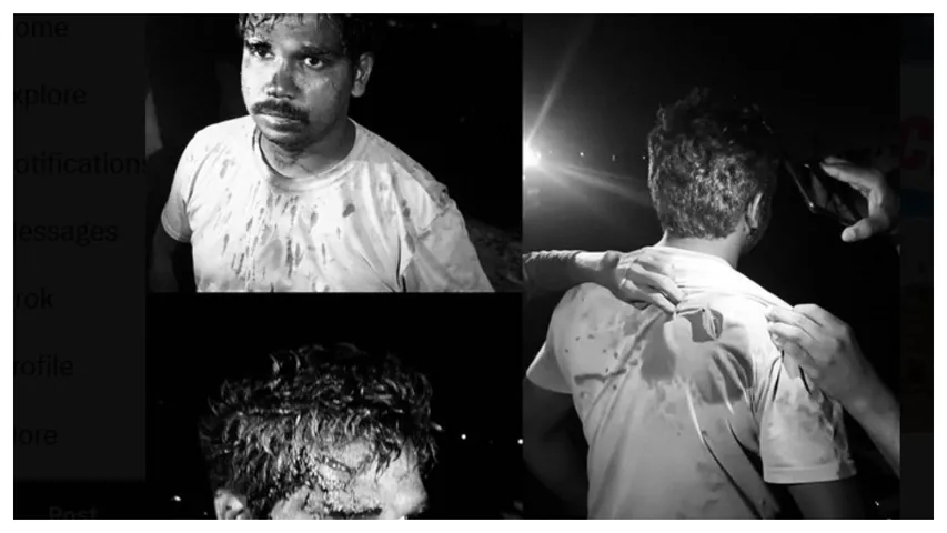 Unidentified Persons Attacked Constable   