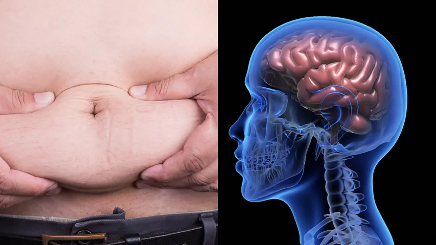brain and Obesity