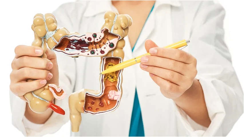 Intestinal health