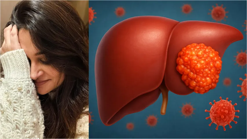 Tv Actress Dipika Kakar diagnosed with liver cancer