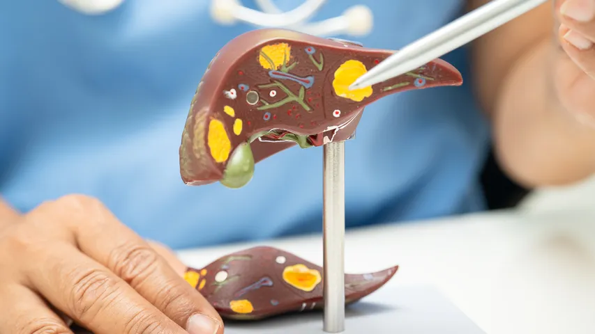 Fatty Liver