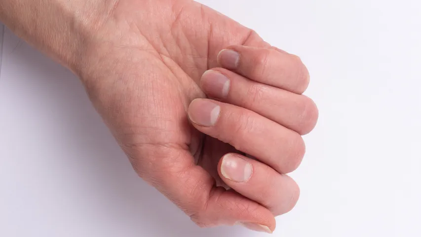 nails Scratches