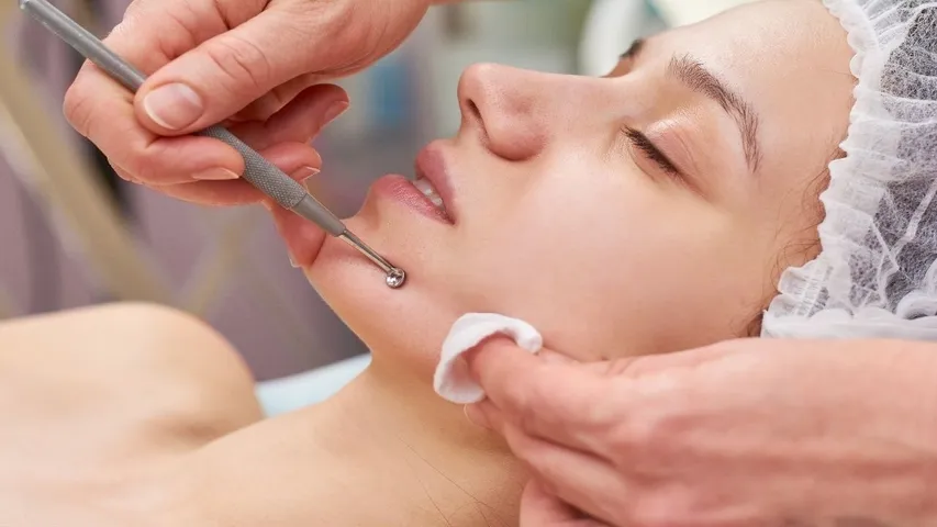 Unwanted Hair