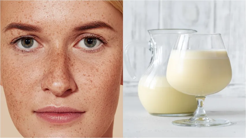Raw Milk Dark Spots