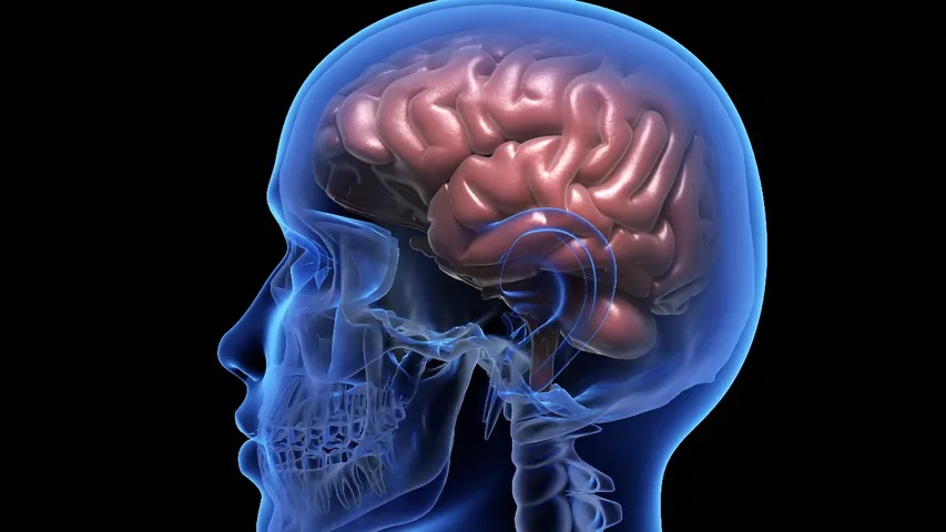 Brain Stroke
