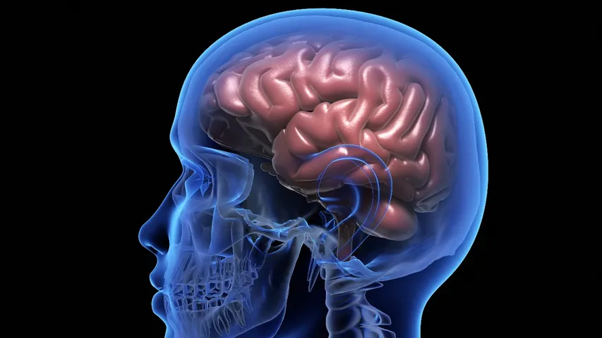 Brain Tumor