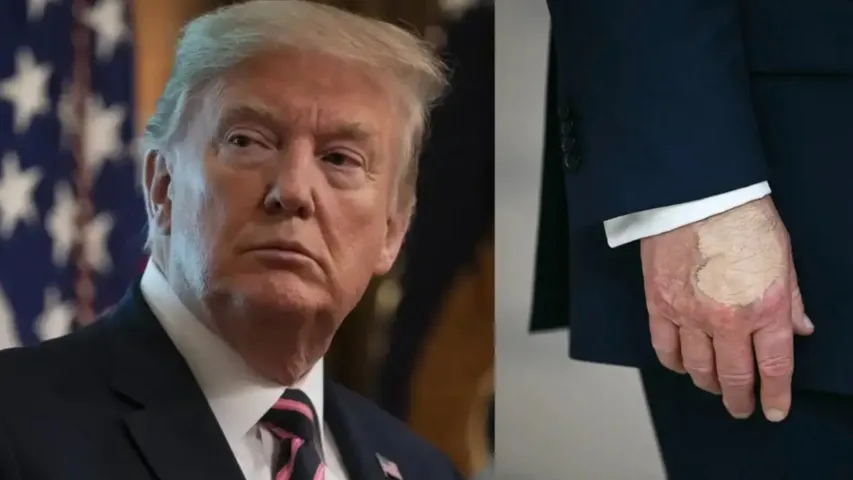 Trump health