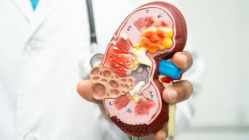 Kidney