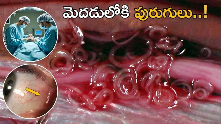 Worm in Human Eye
