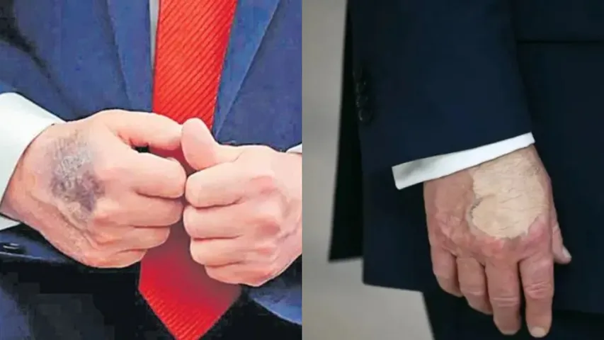 trump health