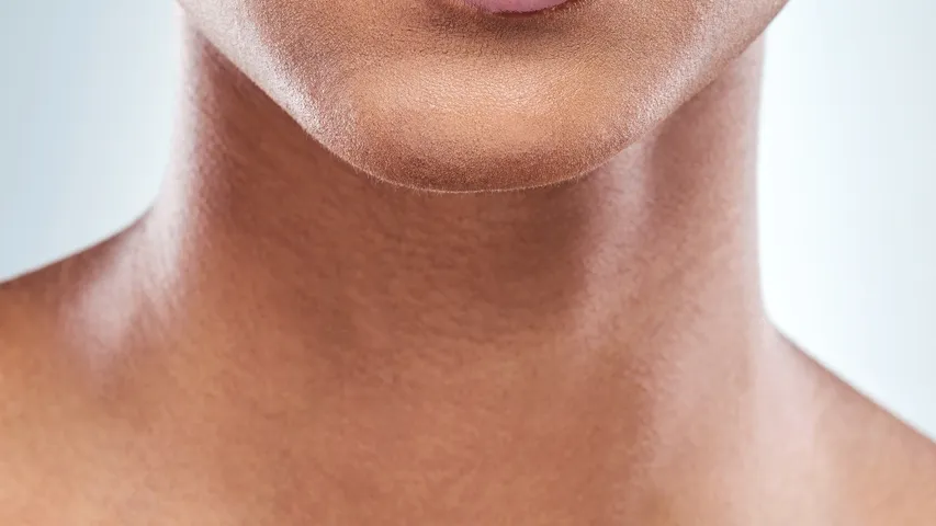 Black spots on the neck