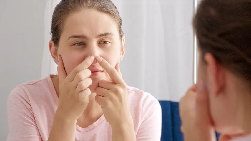 pimple nose