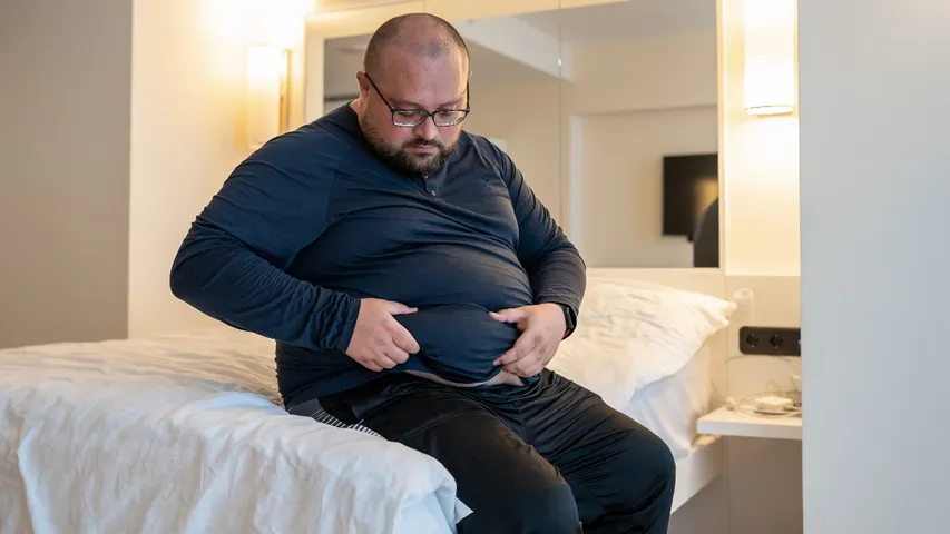 Obesity