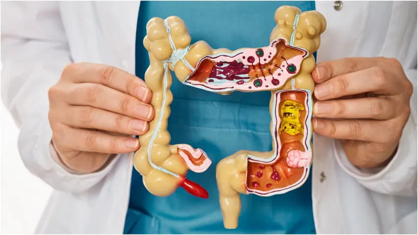 Digestive issues
