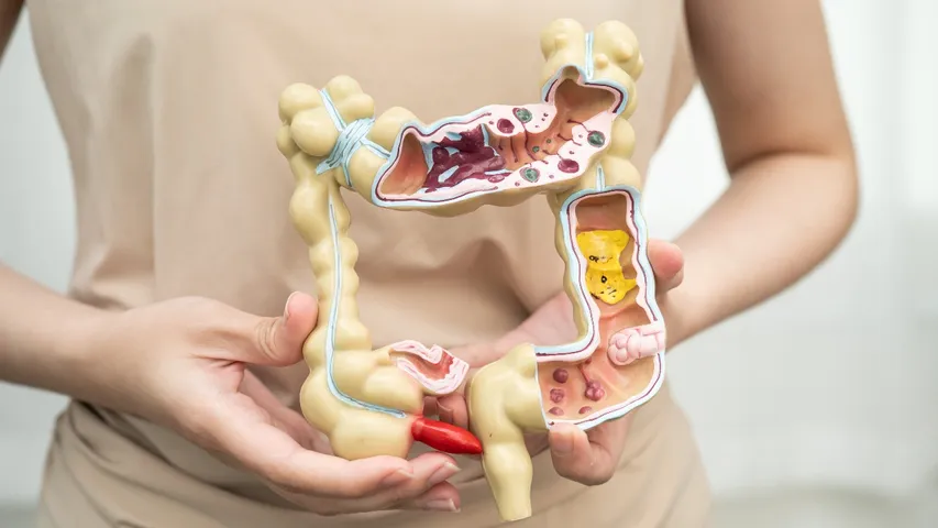Gastrointestinal Diseases