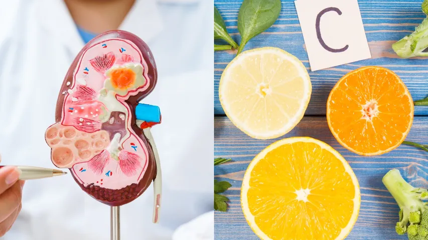 Kidney and Vitamin C