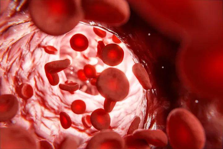 anemia2