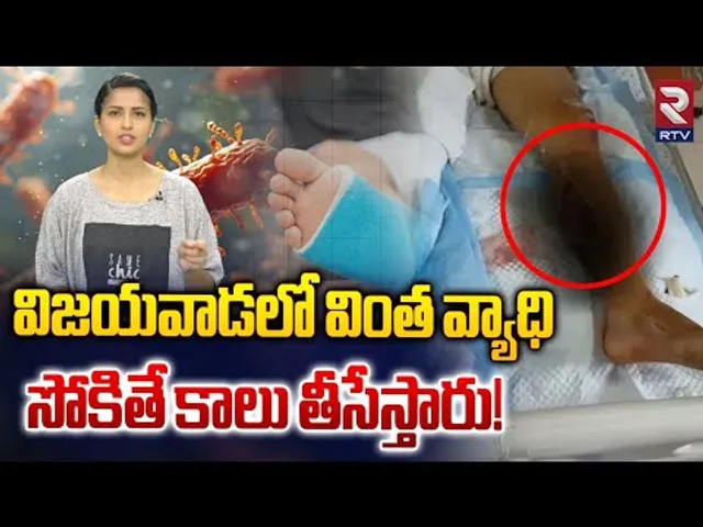 విజయవాడలో వింత వ్యాధి.. సోకితే కాలు తీసేస్తారు! | Flesh-Eating Bacterial Infection In Andhra Pradesh