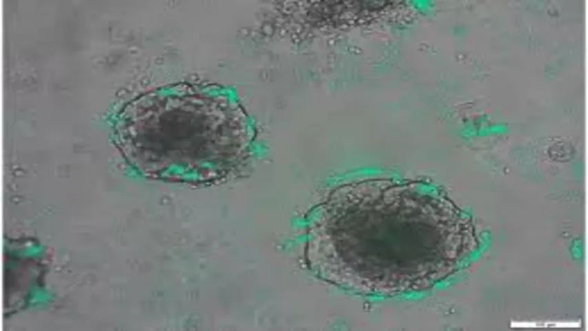 Bacteria : సరికొత్త టెక్నాలజీ..ఇకపై క్యాన్సర్‎ని ఇలా కూడా గుర్తించవచ్చు..!!