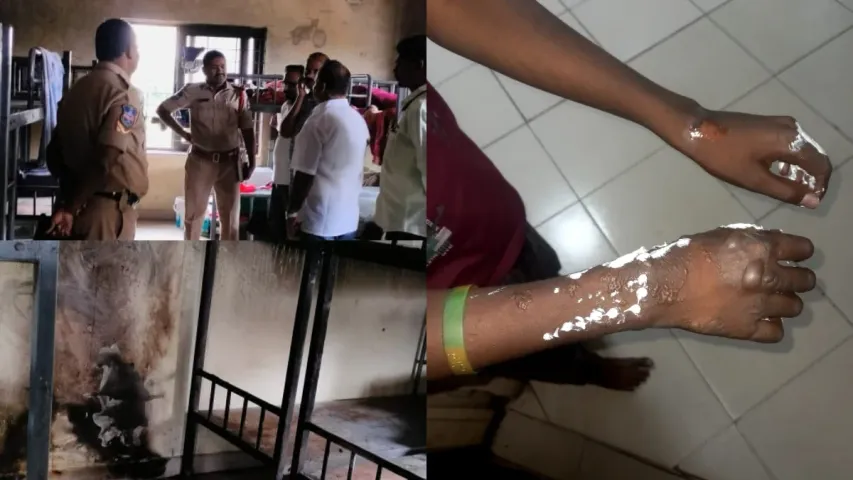 Telangana News: హైదరాబాద్‌ గురుకులంలో అగ్ని ప్రమాదం.. విద్యార్థులకు గాయాలు