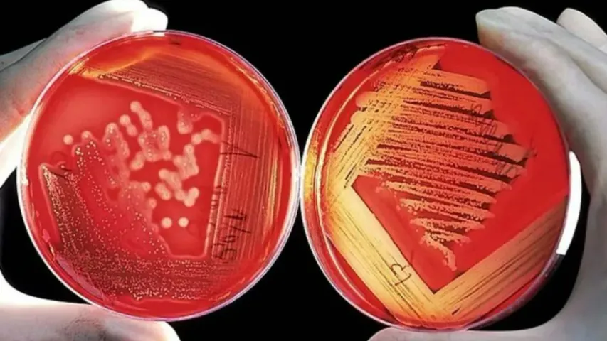 Deadli Bacteria: అమెరికాను వణికిస్తున్న డెడ్ లీ బ్యాక్టీరియా!