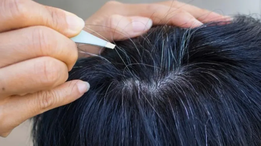 Hair Re generation: హెయిర్‌  రీ జనరేషన్‌తో బట్టతలకు చెక్‌ పెట్టేదాం!